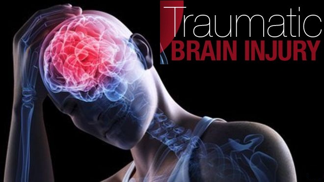 traumatic brain injury treatment