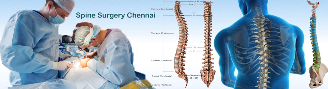 List of Top 12 Spine Surgeons in Chennai | List of Best ...