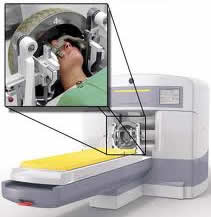 Low Cost Radiosurgery India