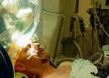 Deep Brain Stimulation Therapy India