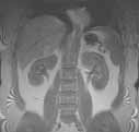 Sample image: MRI of the abdomen showing liver and kidneys - frontal (coronal view)
