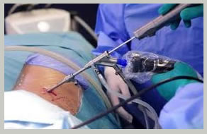 benefits endoscopic spine surgery India, preparations endoscopic spine surgery, common procedures endoscopic spine surgery