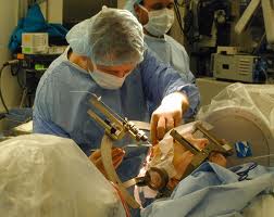 low cost deep brain stimulation therapy India