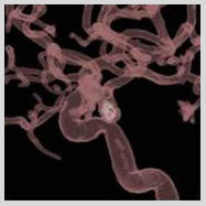 low cost neurosurgery India, neurosurgery benefits India