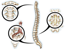 best spine surgeons India, top spine hospitals India, spine surgery hospitals India