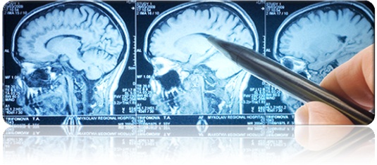 Types of Neurosurgery Types of Neurosurgery