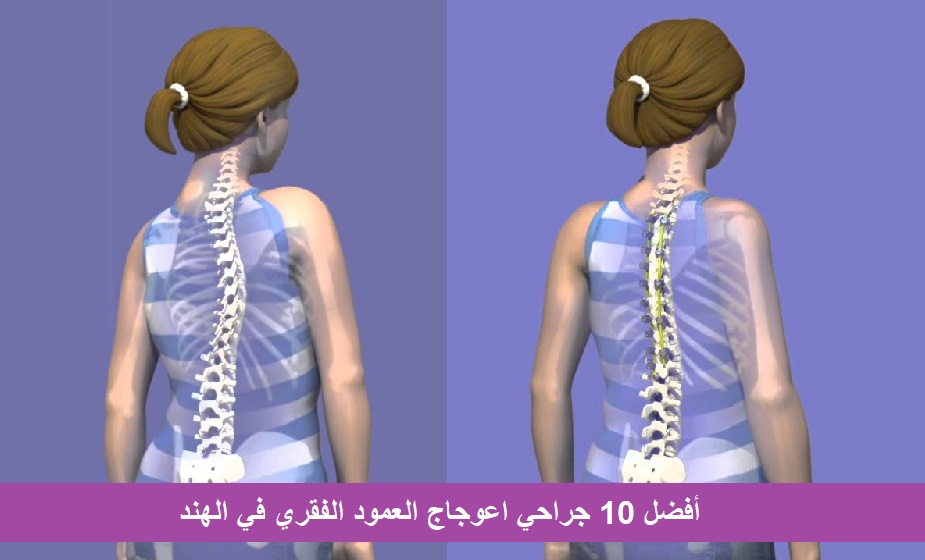 Top Scoliosis Surgeons in India Top 10 Scoliosis Surgeons in India