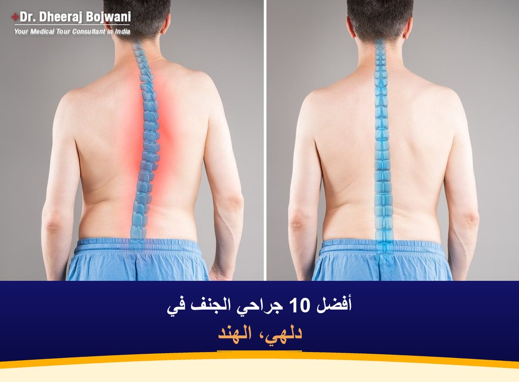 أفضل 10 جراحي الجنف في دلهي، الهند (2026-2027)