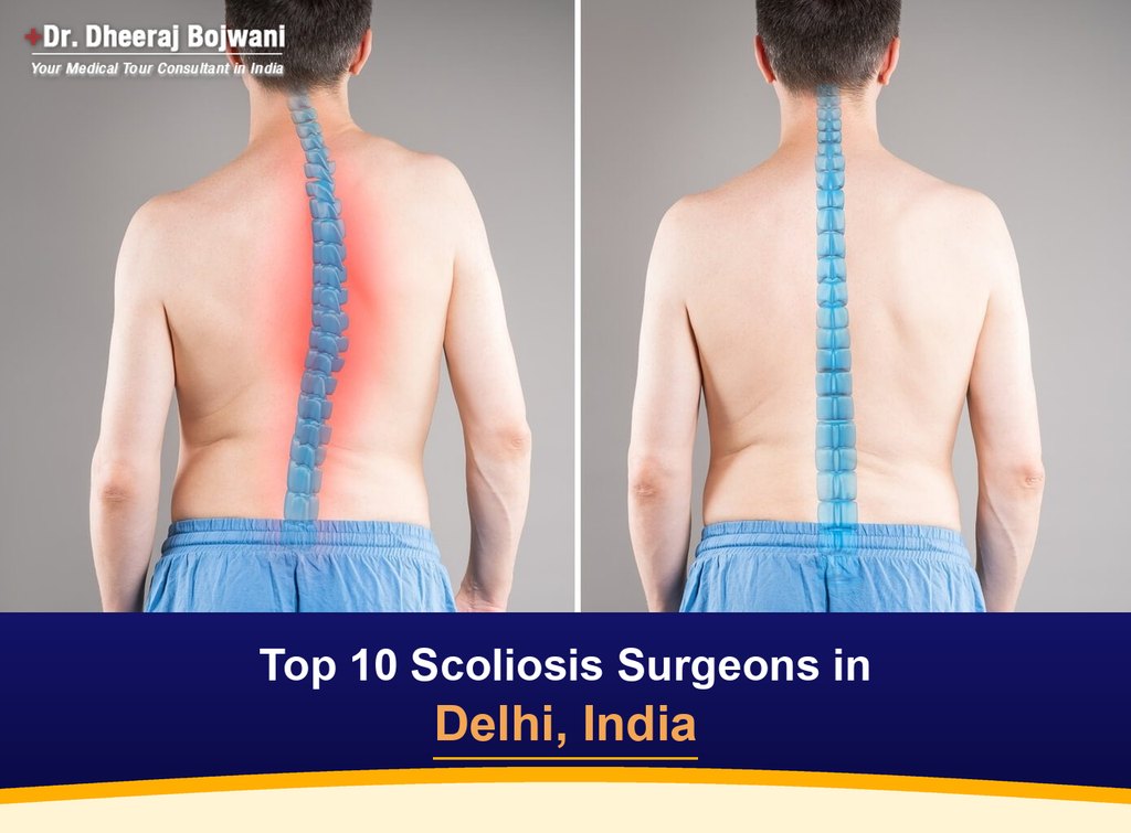 Top 10 Scoliosis Surgeons in Delhi, India (2026-2027)