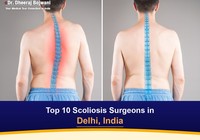 Top 10 Scoliosis Surgeons in Delhi, India (2026-2027)