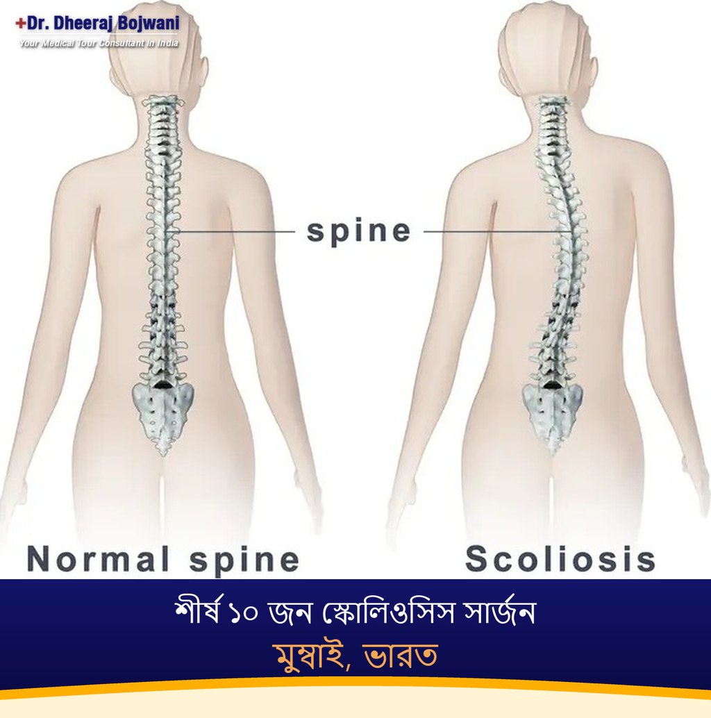 মুম্বাই, ভারতের শীর্ষ ১০ জন স্কোলিওসিস সার্জন (2026-2027)