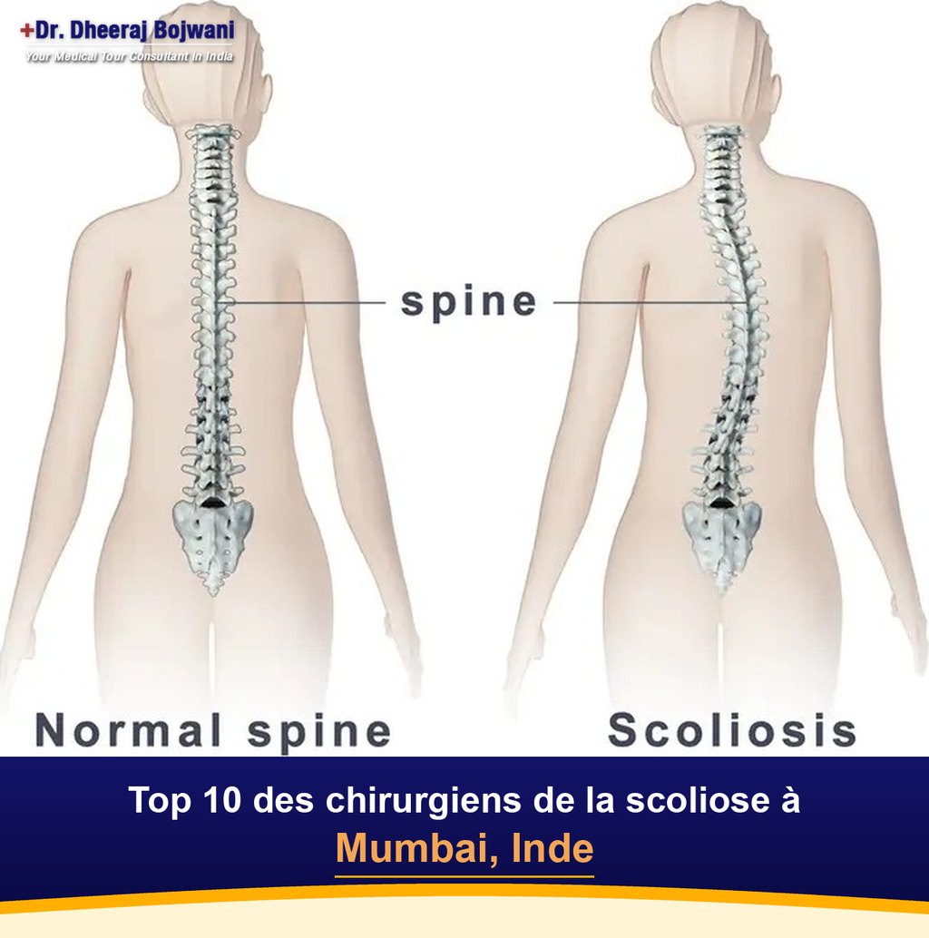 Top 10 des chirurgiens de la scoliose à Mumbai, Inde (2026-2027)