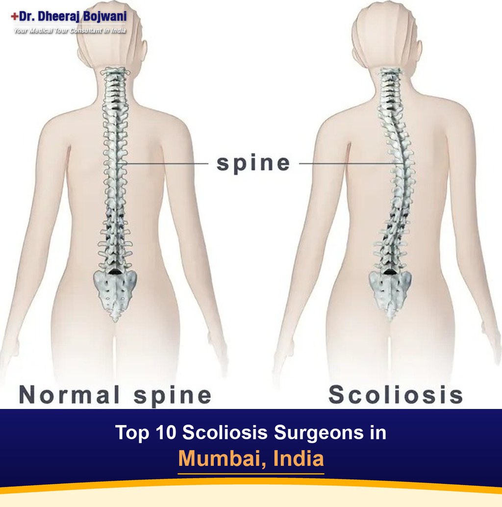 Top 10 Scoliosis Surgeons in Mumbai, India (2026-2027)