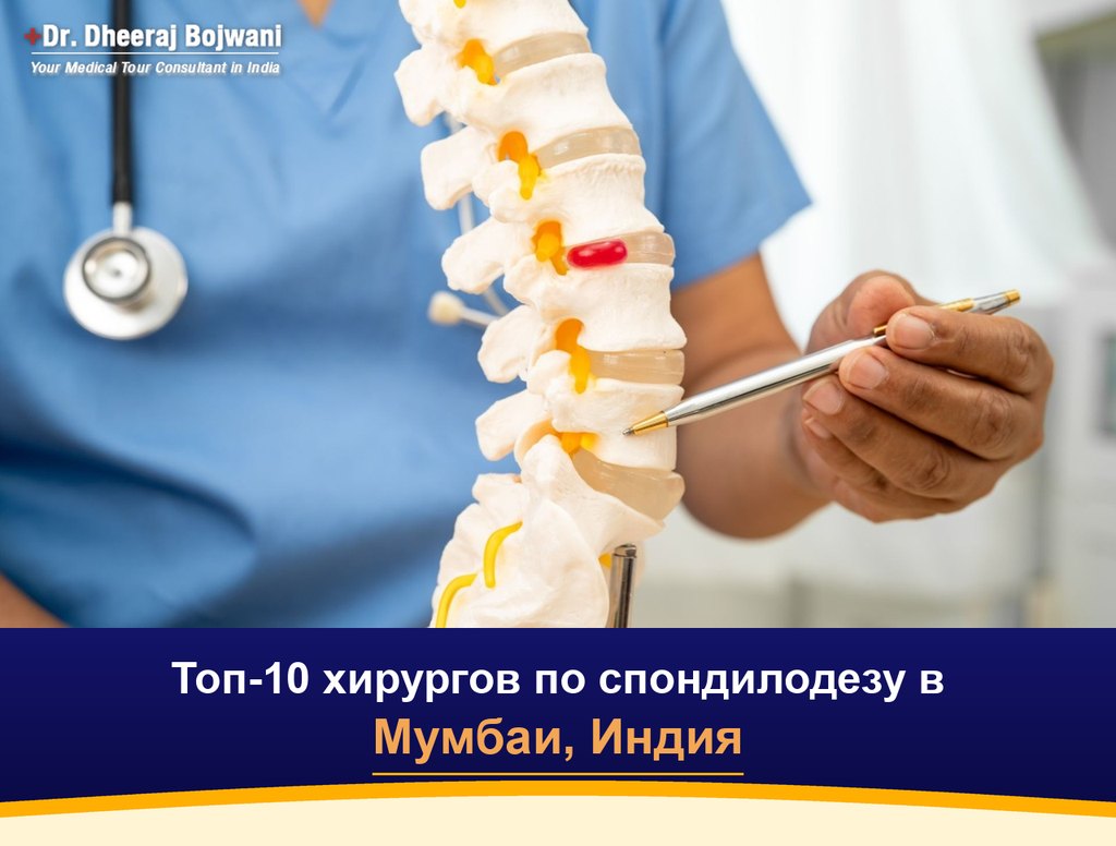Топ-10 хирургов по спондилодезу в Мумбаи, Индия (2026-2027)