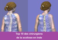 Top 10 des chirurgiens de la scoliose en Inde