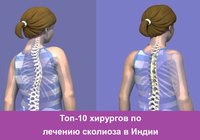 Топ-10 хирургов по лечению сколиоза в Индии