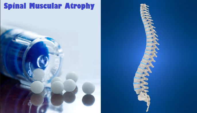 spinal-muscular-atrophy