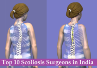 Top 10 Scoliosis Surgeons in India