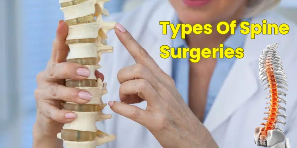 Types Of Spine Surgeries