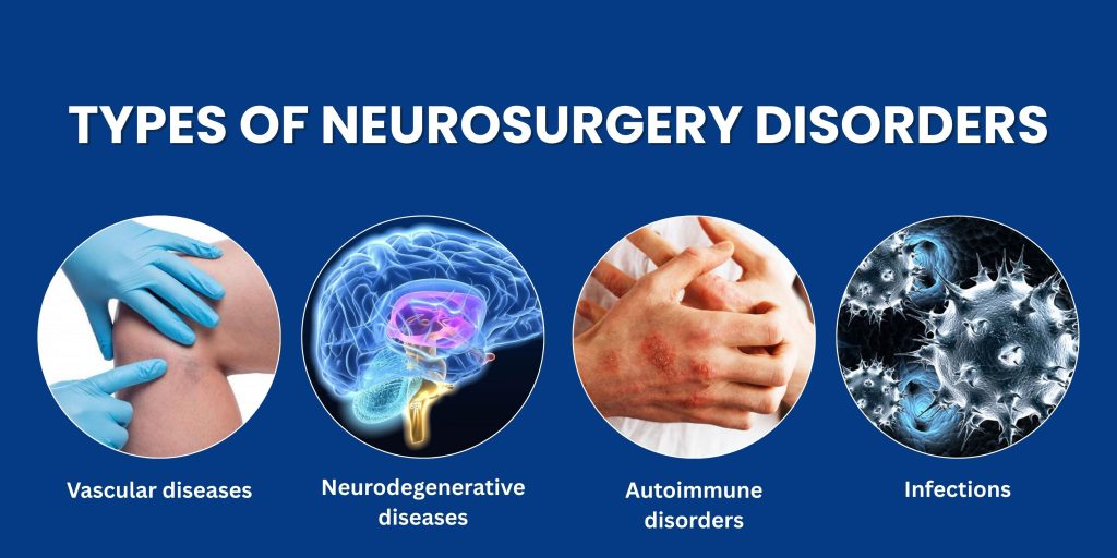 Types Of Neurosurgery Disorders