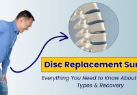 Disc Replacement Surgery