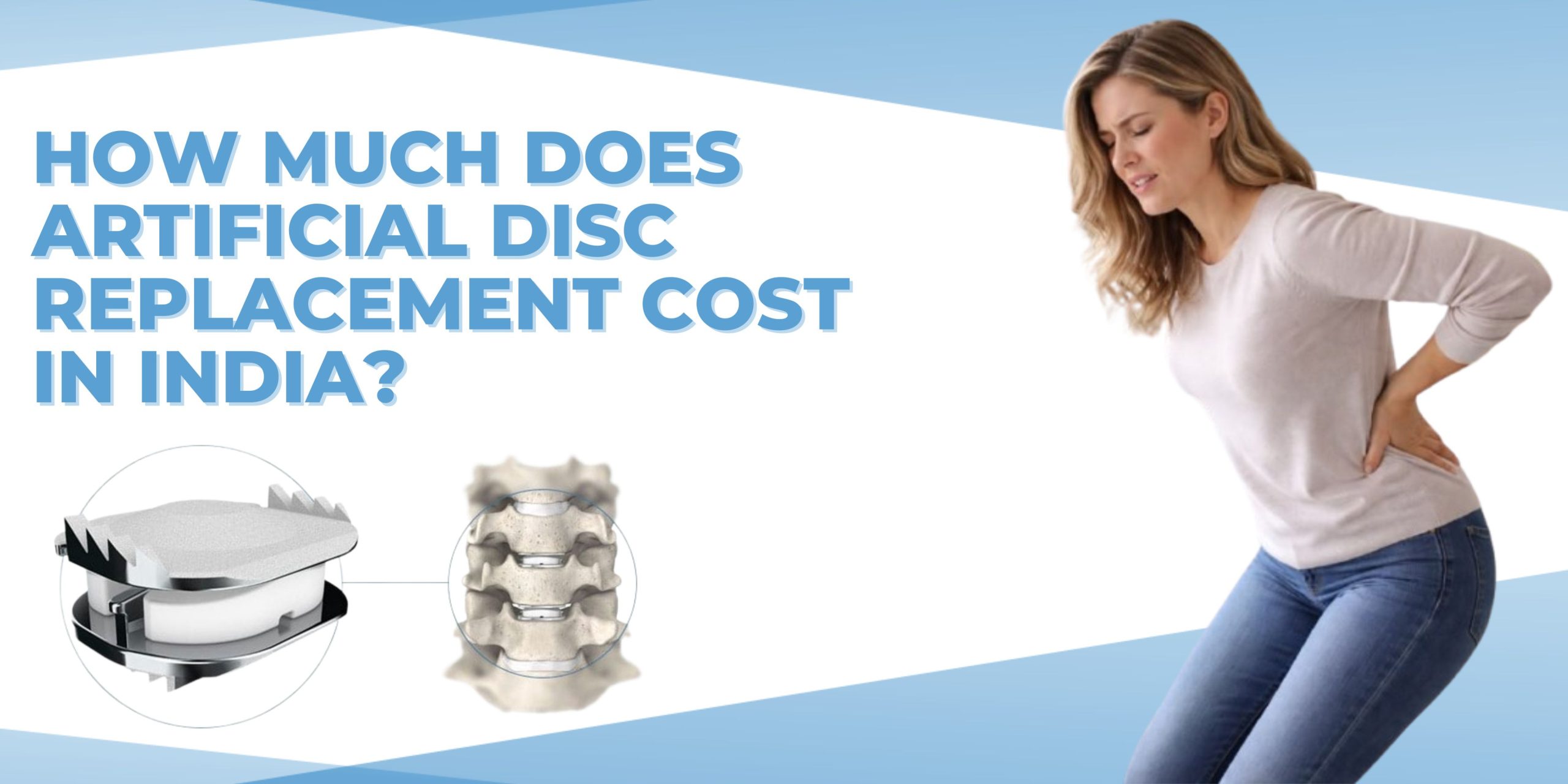 How Much Does Cost of Artificial Disc Replacement Surgery in India?