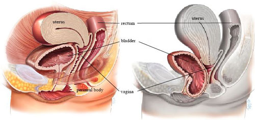 Best bladder prolapsed repair surgeons in Pune