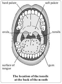 Tonsillectomy (Adult) Surgery in India