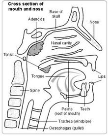 Stapedectomy Surgery in India