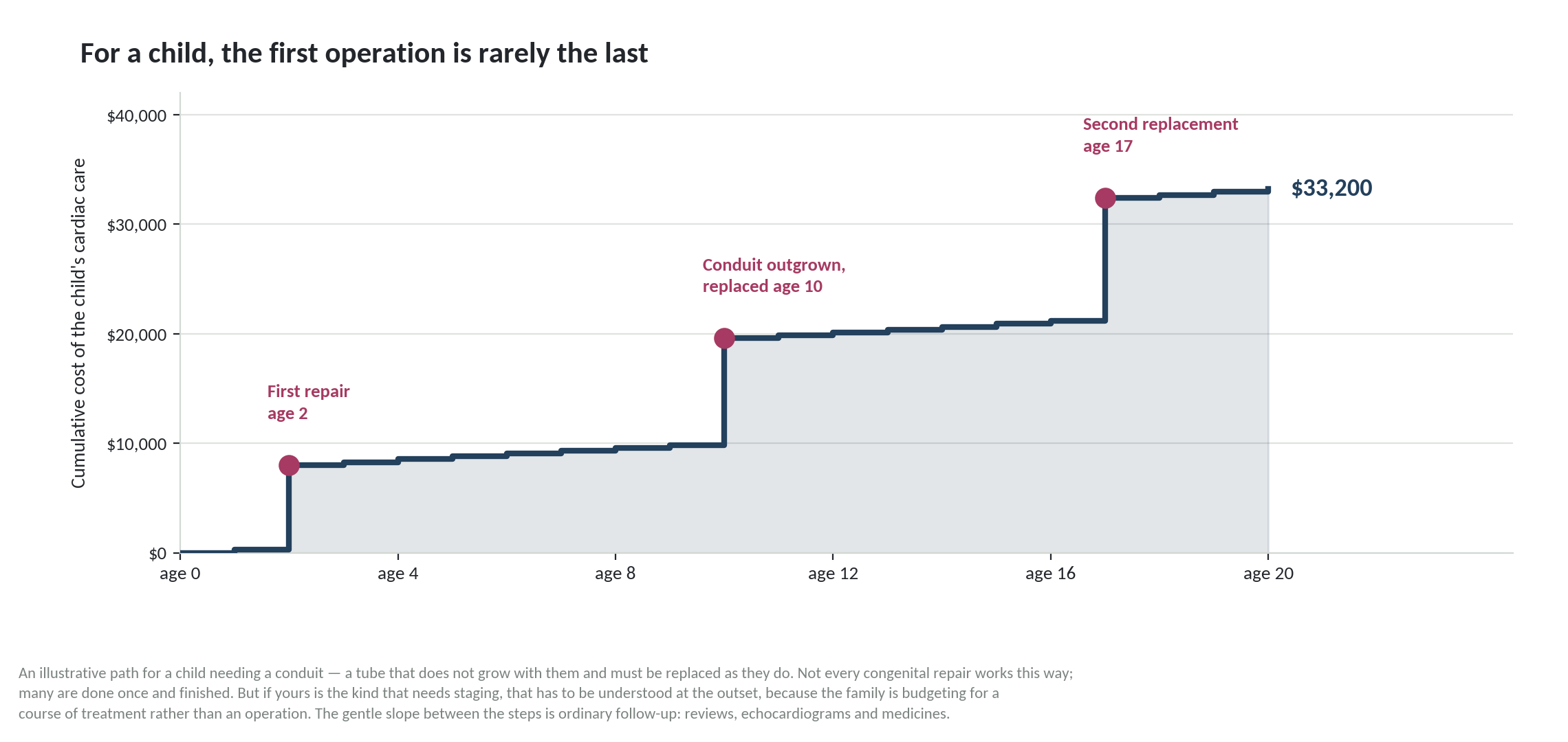 Chart: Is the money arranged, and have you counted the second operation?