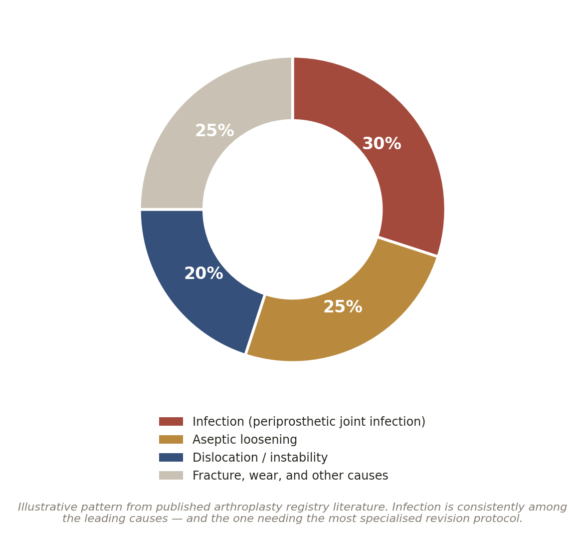 Chart: Infected, or just loose?