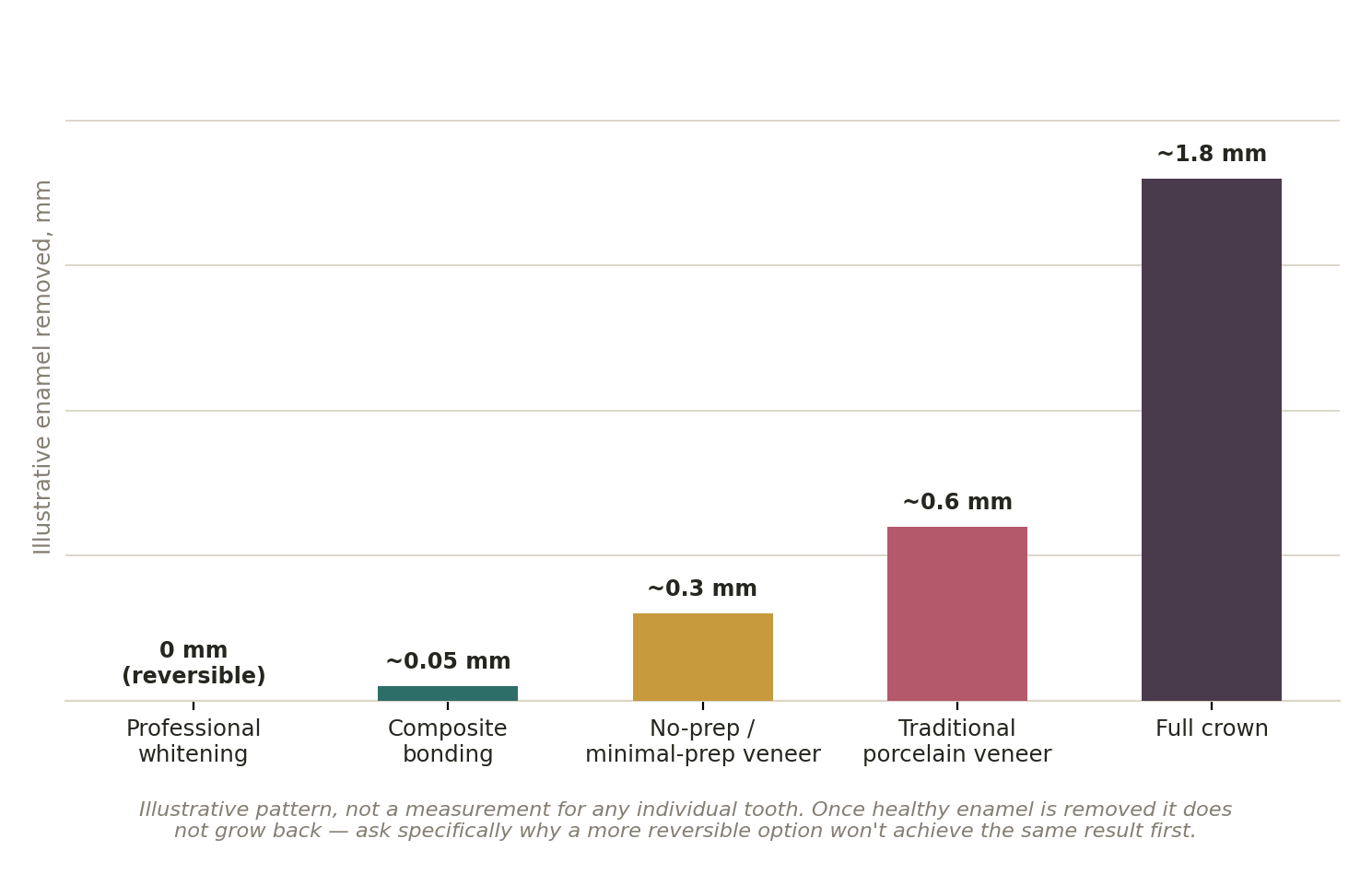 Chart: Grinding, or just whitening?