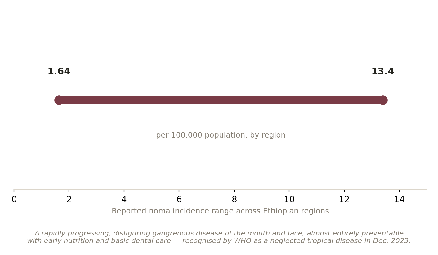 Chart: When a toothache becomes a face