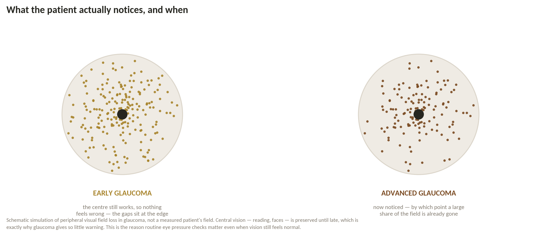 Chart: Reversible, or only preventable from here?