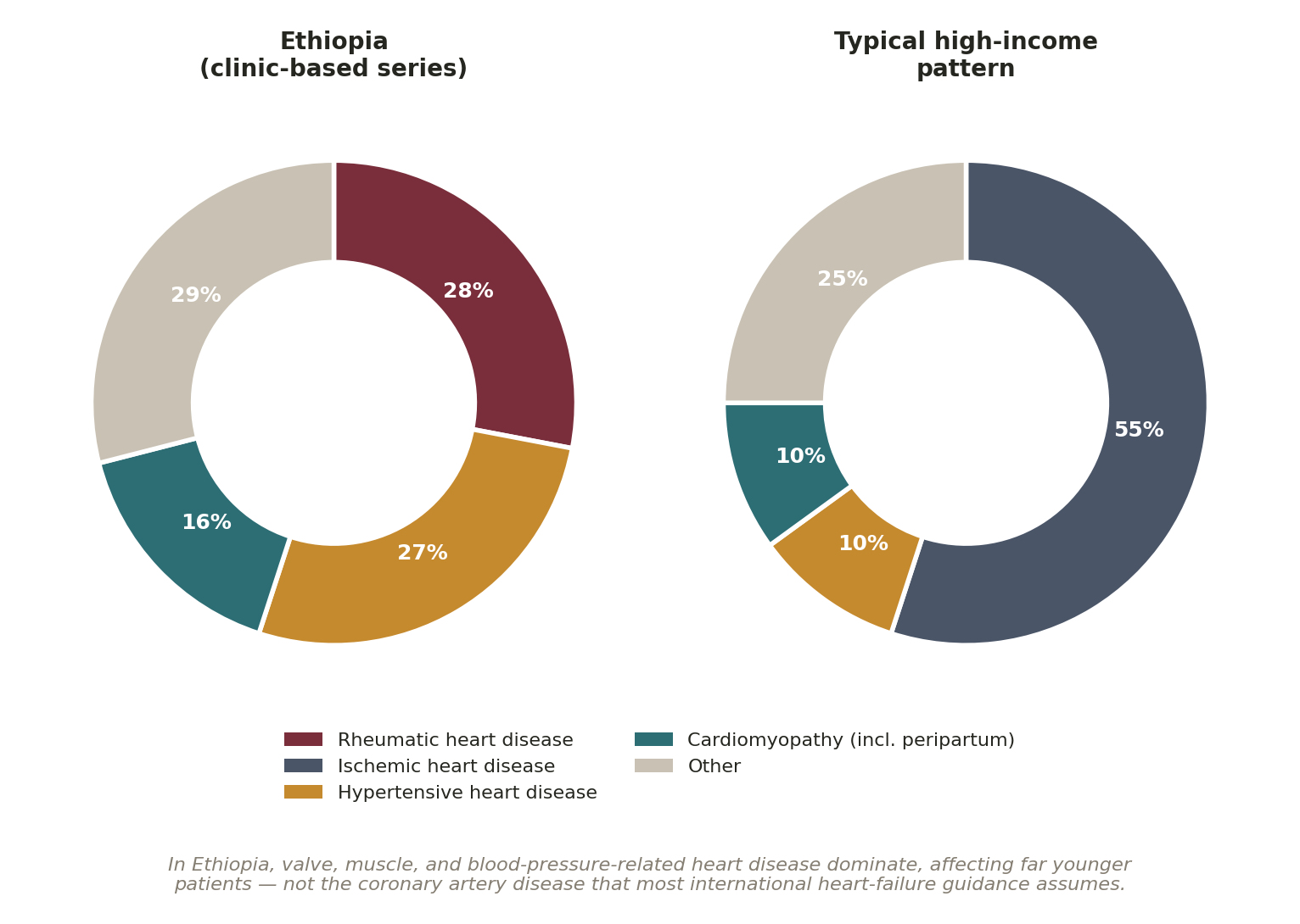 Chart: Which heart failure, and whose?