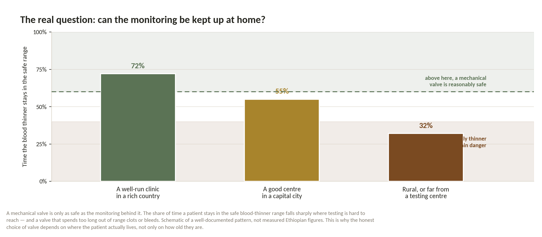 Chart: Which valve — and can you monitor it at home?