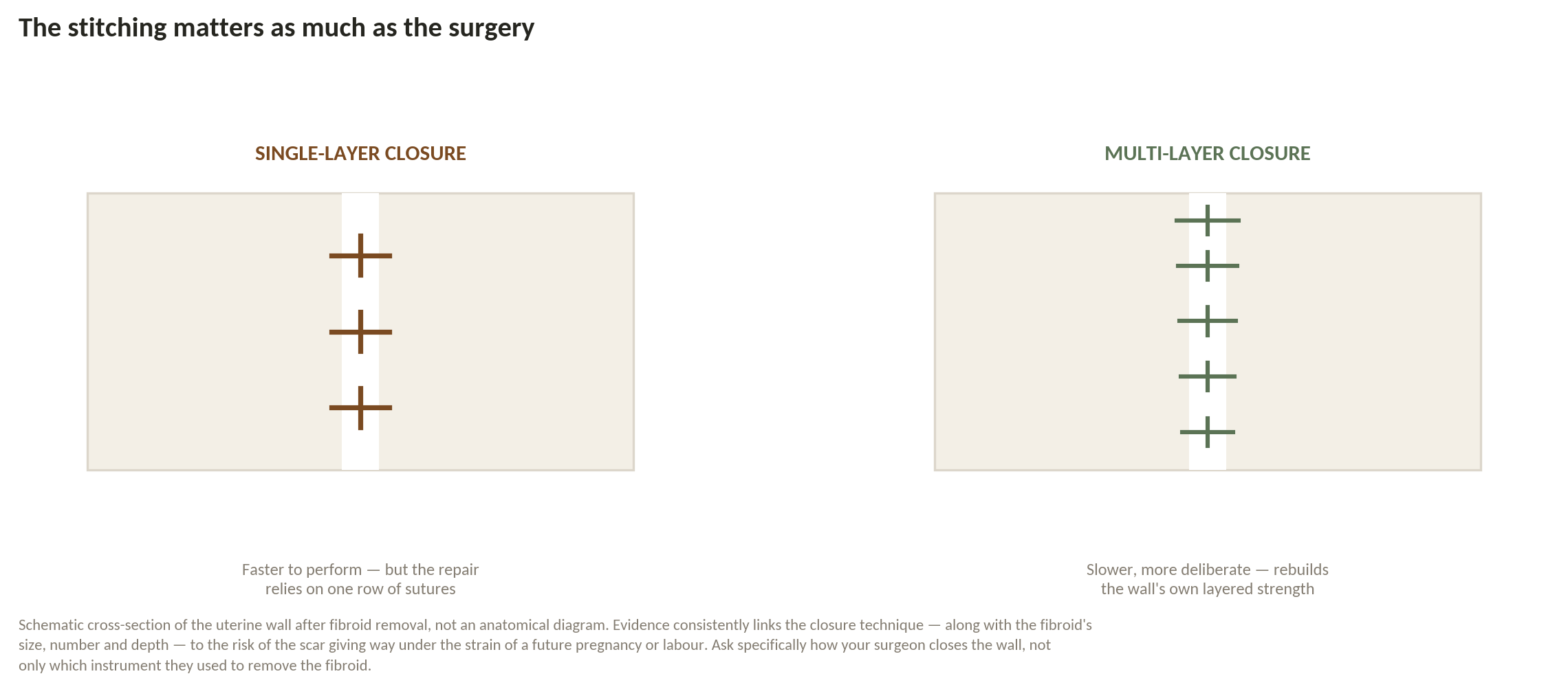 Chart: Does the closure protect a future pregnancy?