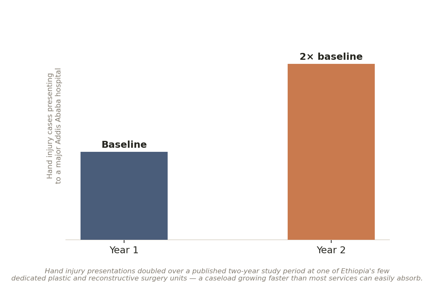 Chart: Burns, or hands, or both?