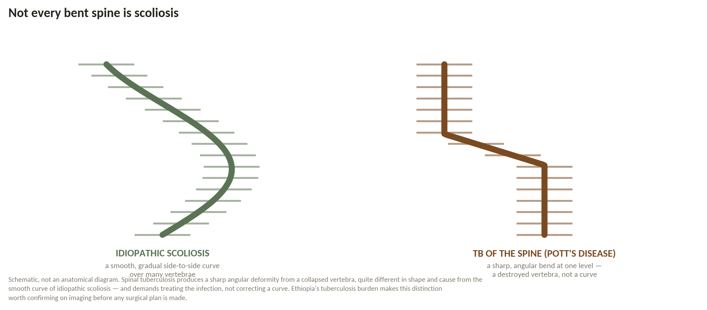 Chart: Is it idiopathic, or something else?