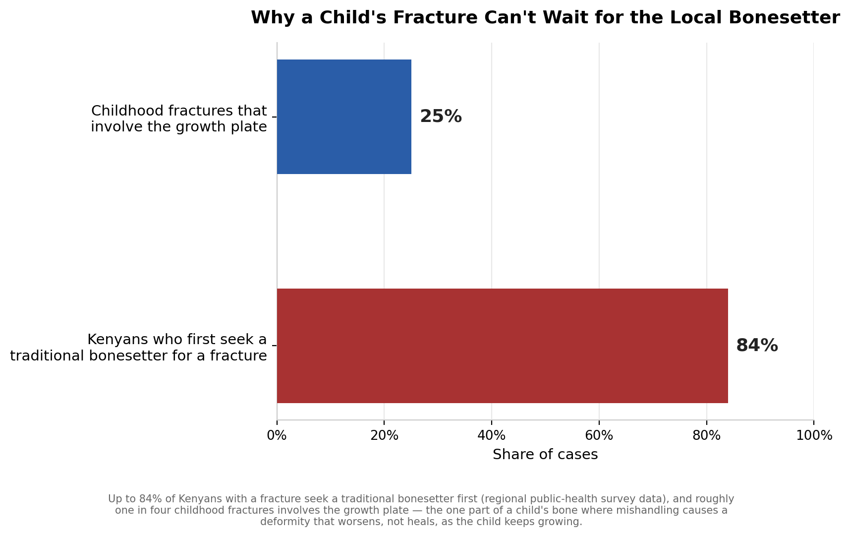 Chart: Before the surgeon: why a child's bone is a moving target