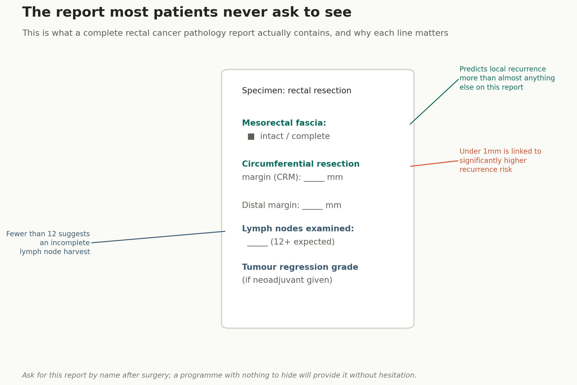 Chart: The report that tells you what actually happened