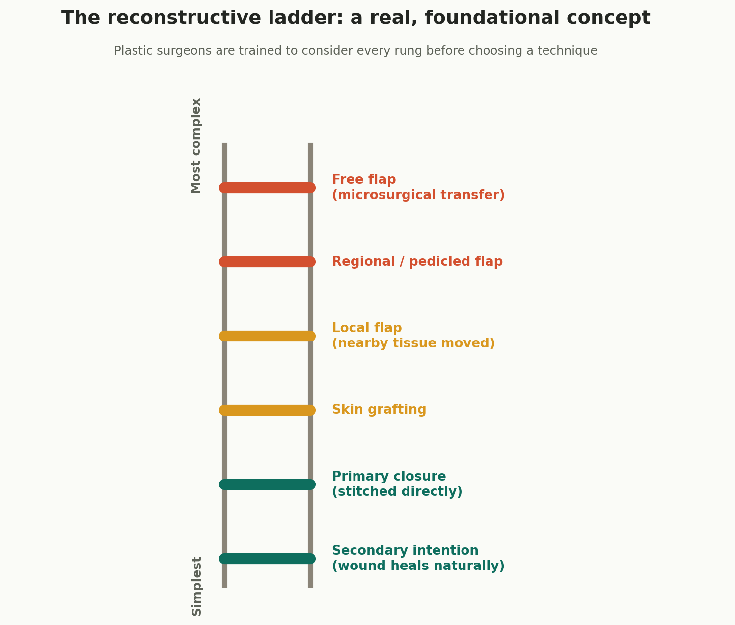 Chart: The reconstructive ladder: a real, foundational concept