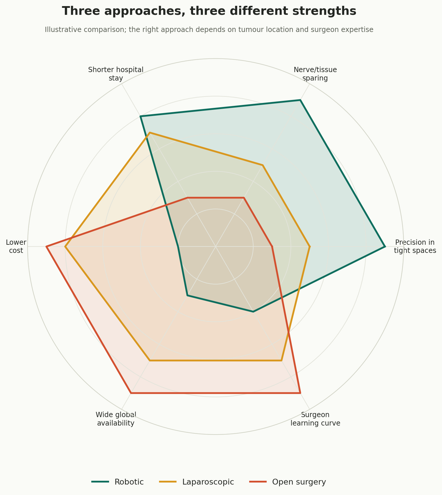 Chart: Tight, complex spaces