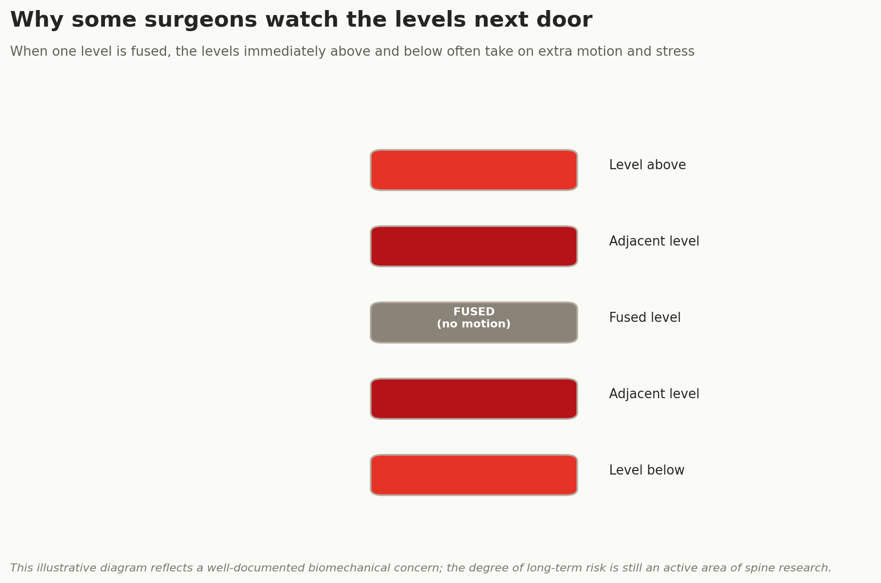 Chart: Why some surgeons watch the levels next door