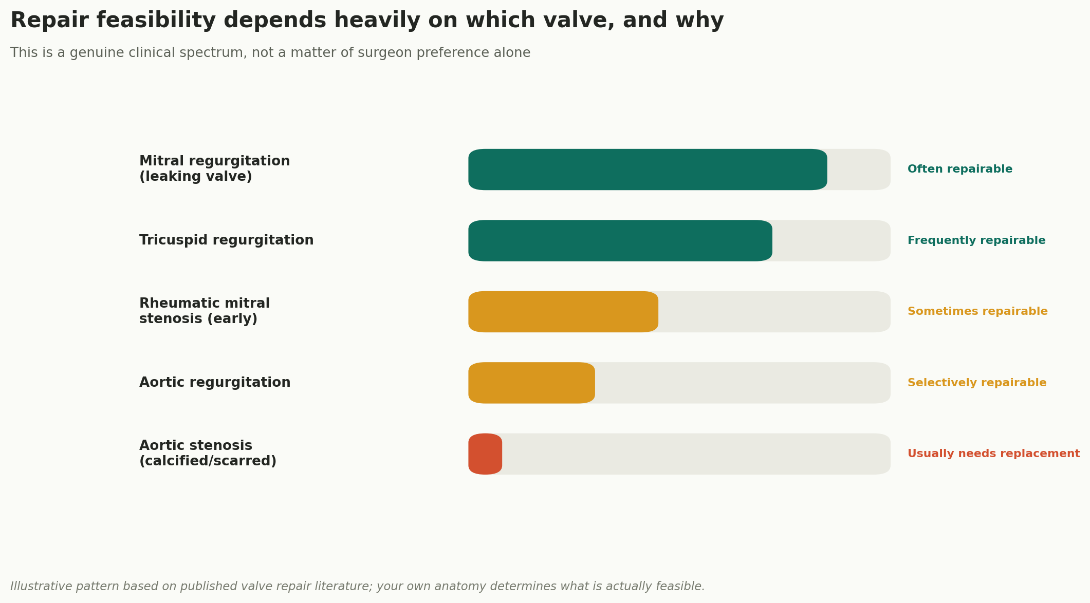 Chart: The valve you get to keep