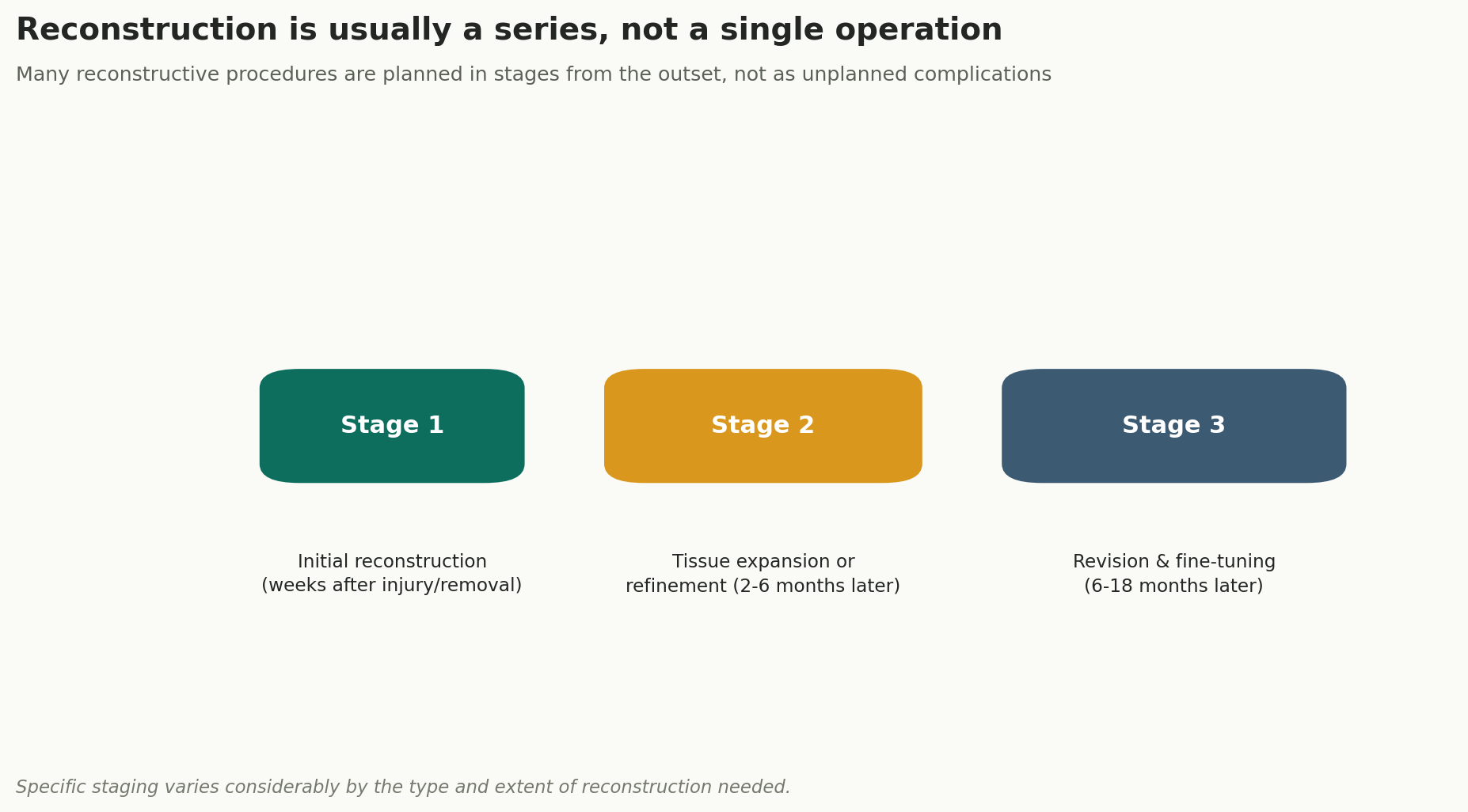 Chart: Reconstruction is usually a series, not a single operation
