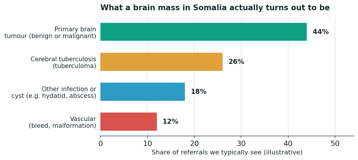 Chart: First, know what a "mass" in the brain actually turns out to be