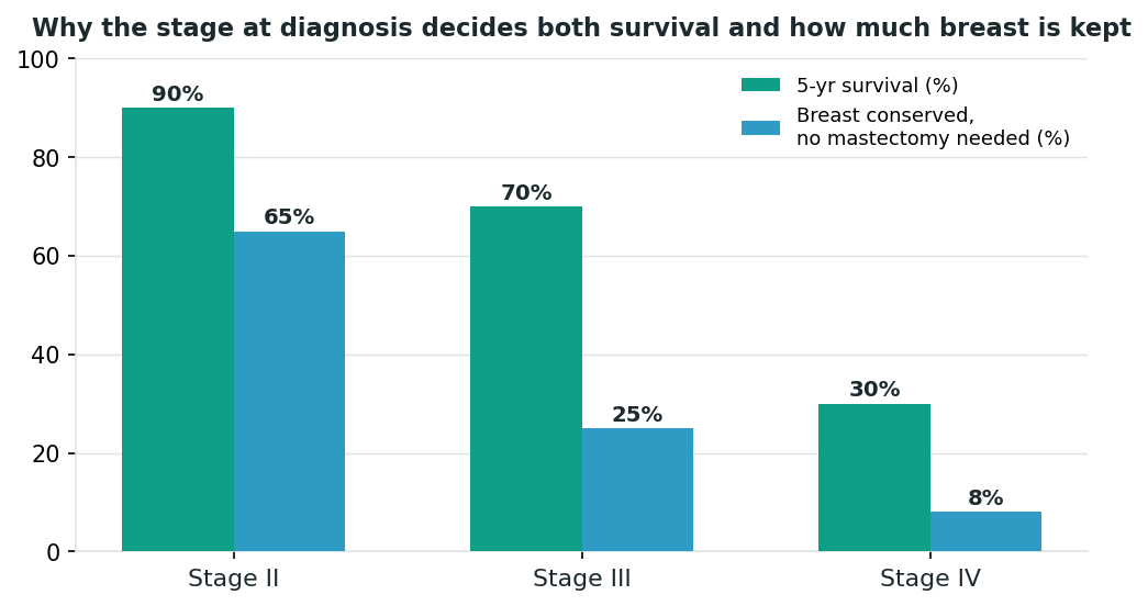 Chart: Why the stage at diagnosis changes almost everything about treatment