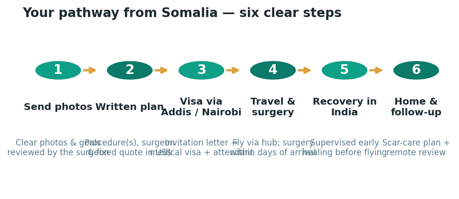 Chart: The practical journey from Somalia — plan it before you fly