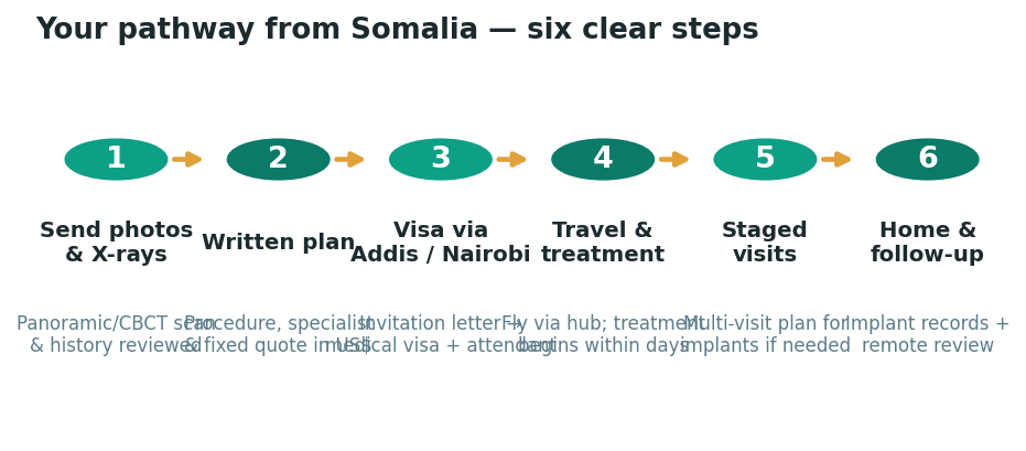Chart: The practical journey from Somalia — plan it before you fly